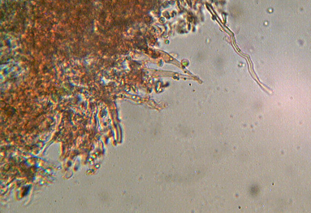 Hyphoderma sambuci
